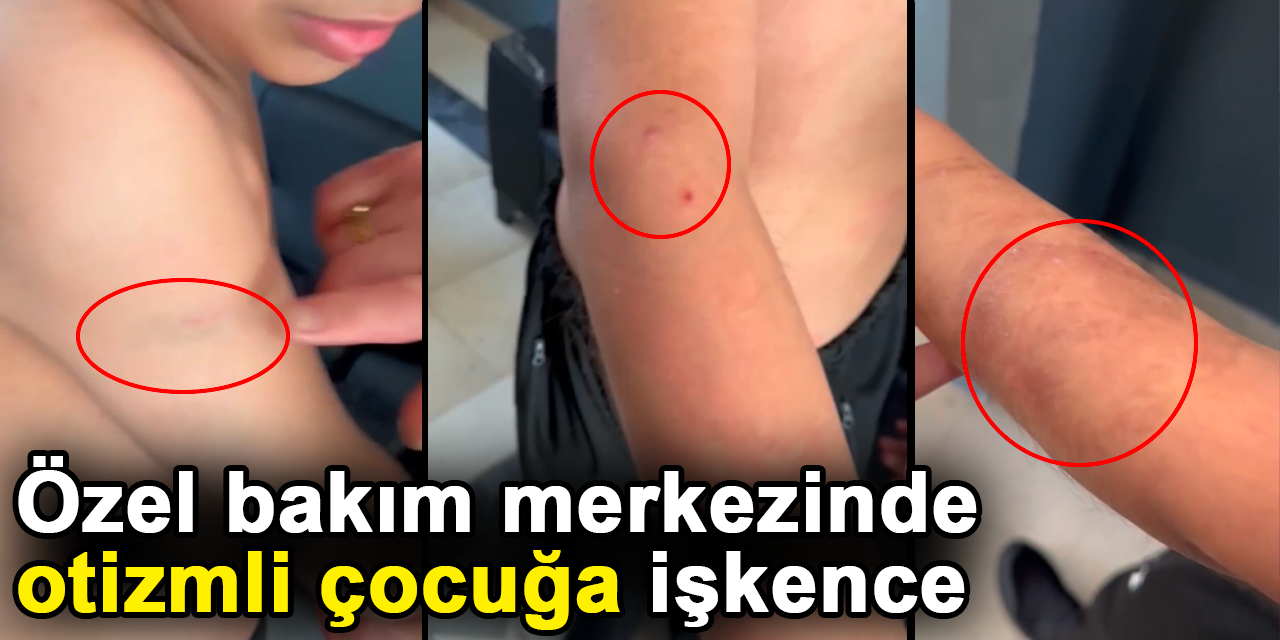 Özel bakım merkezinde otizmli çocuğa işkence